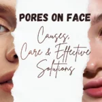 Pores on face